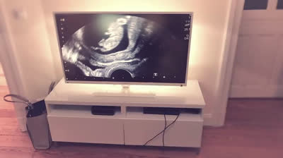 A pregnancy in timelapse