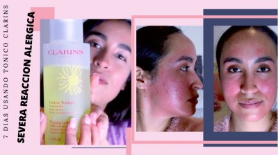 7 dias usando tónico de CLARINS