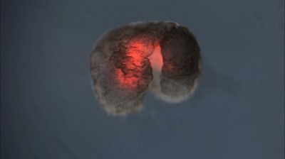 BioRobots: The future of medicine