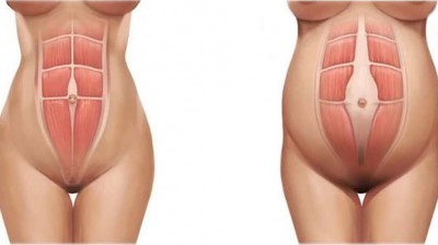 How to regain your shape after giving birth